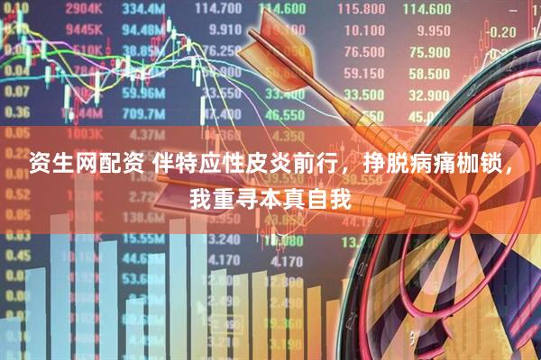 资生网配资 伴特应性皮炎前行，挣脱病痛枷锁，我重寻本真自我